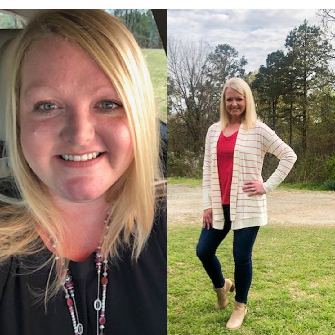 Medical Weight Loss in Tulsa Before & After Photos