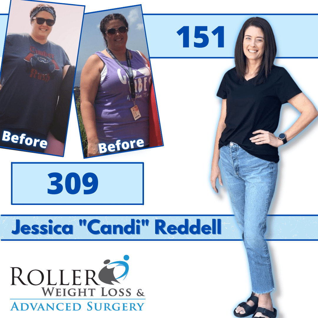 Medical Weight Loss in Tulsa Before & After Photos