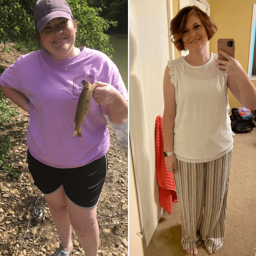 Medical Weight Loss in Tulsa Before & After Photos