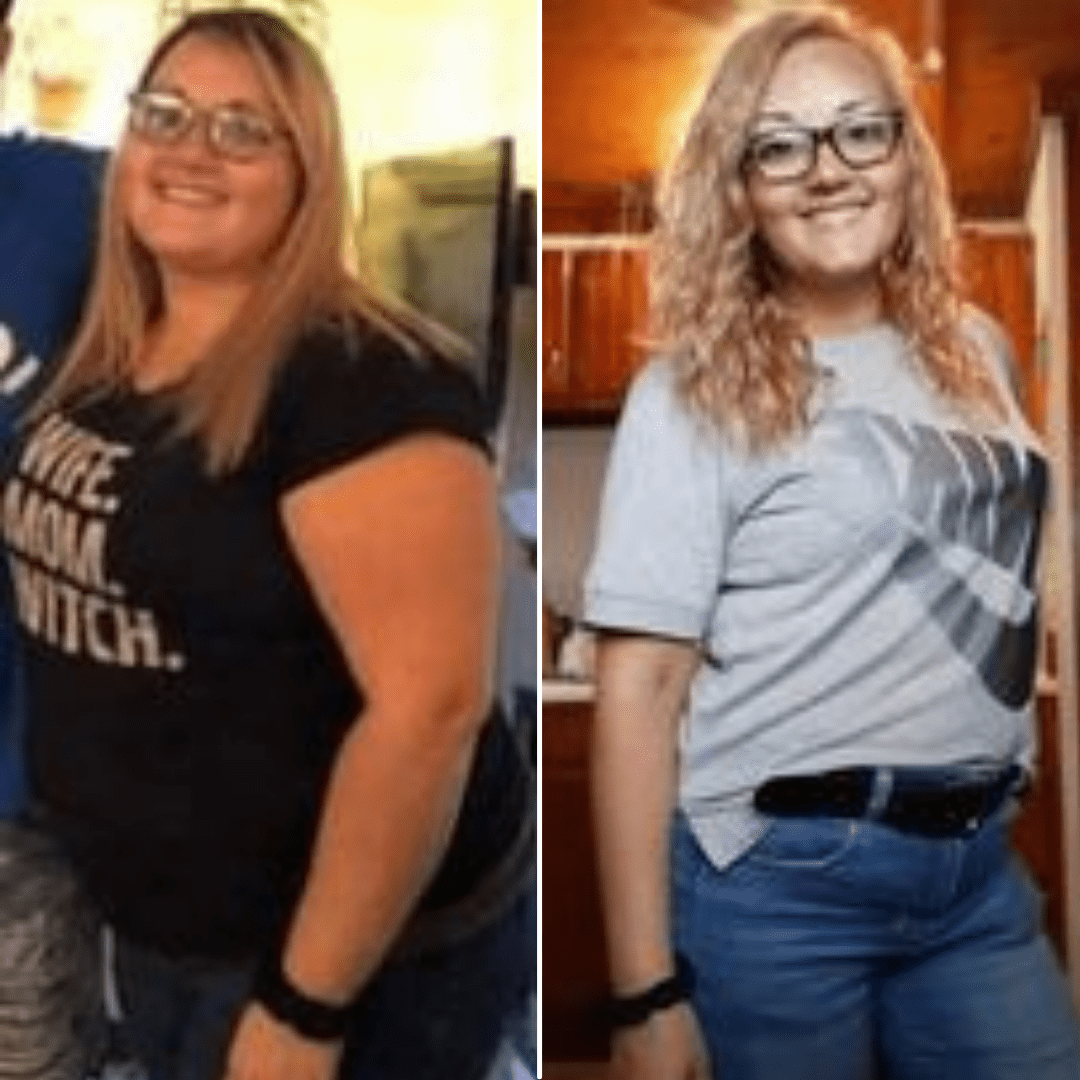 Medical Weight Loss in Tulsa Before & After Photos