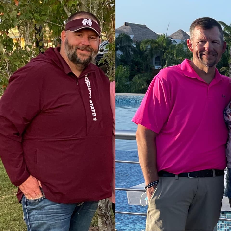 Medical Weight Loss in Tulsa Before & After Photos