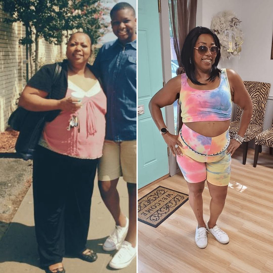 Medical Weight Loss in Tulsa Before & After Photos