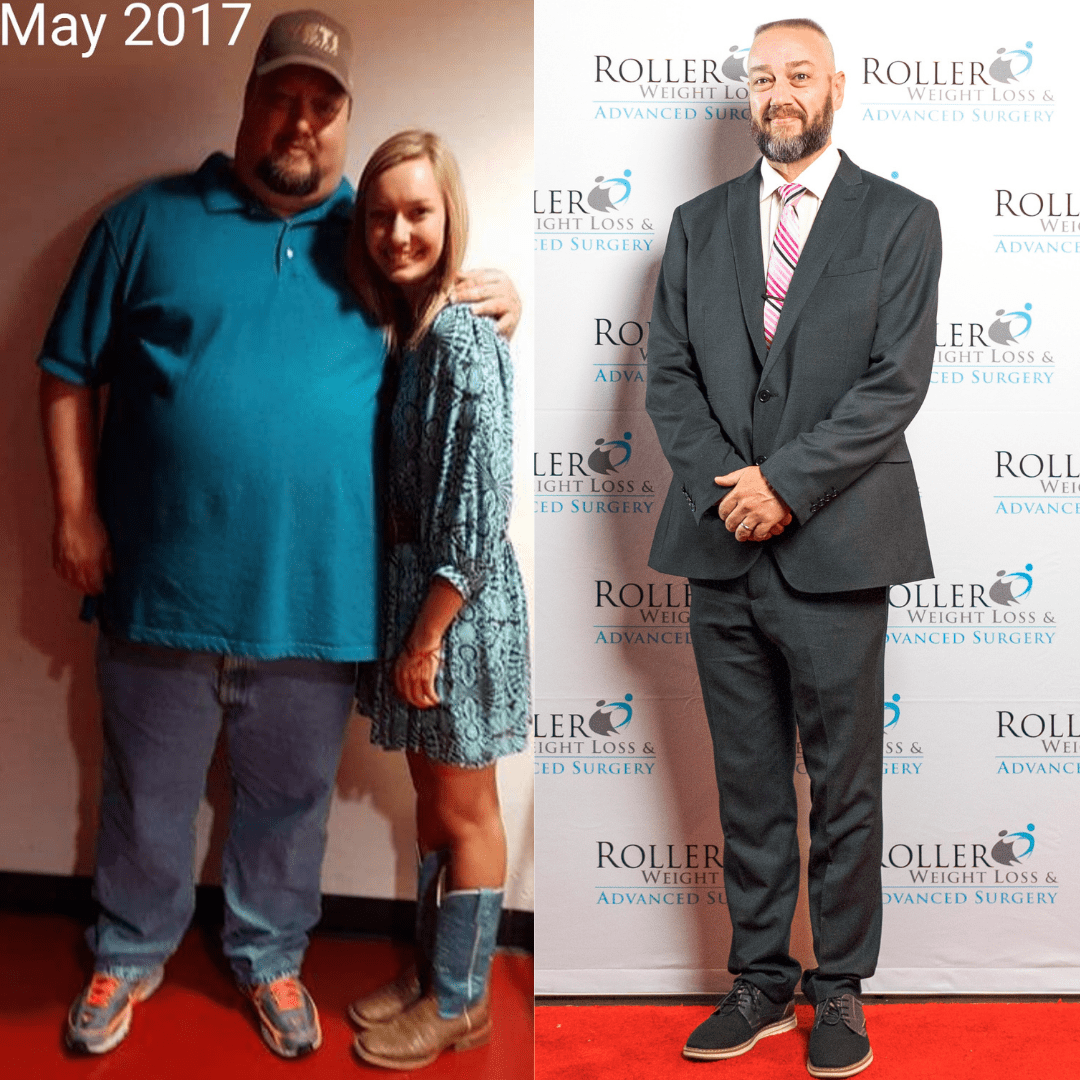 Medical Weight Loss in Tulsa Before & After Photos