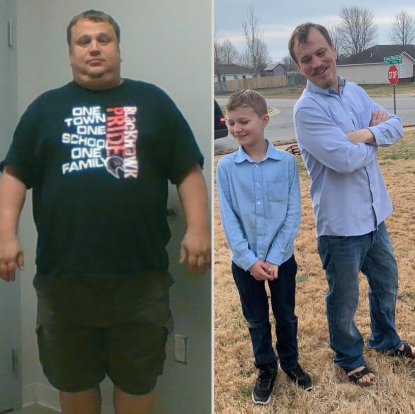 Before and after image of man from weight loss.