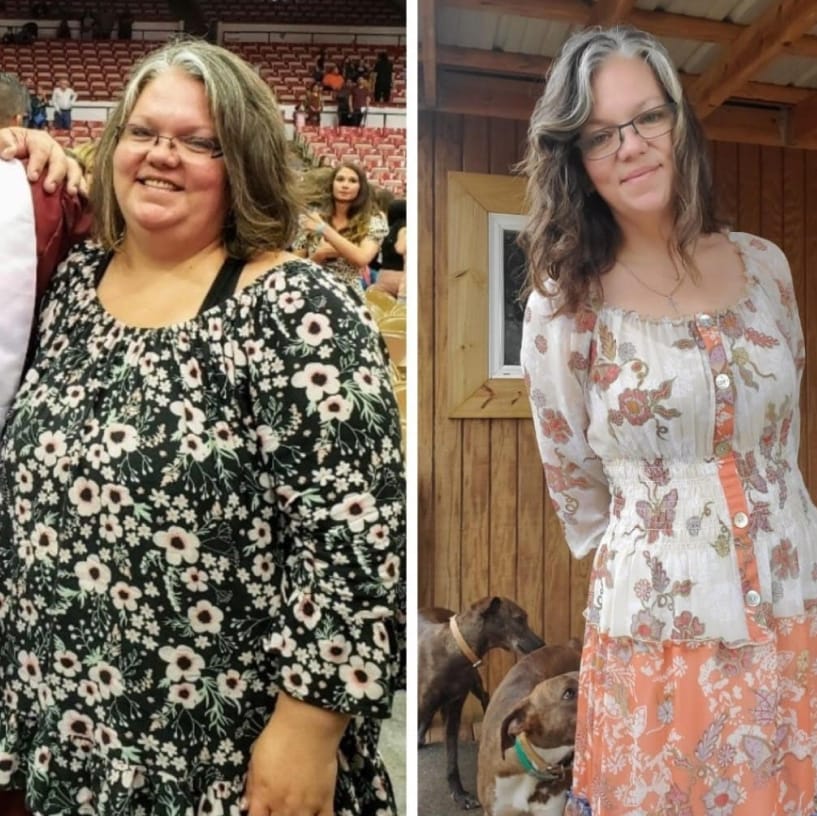 Before and after image of woman from weight loss #5
