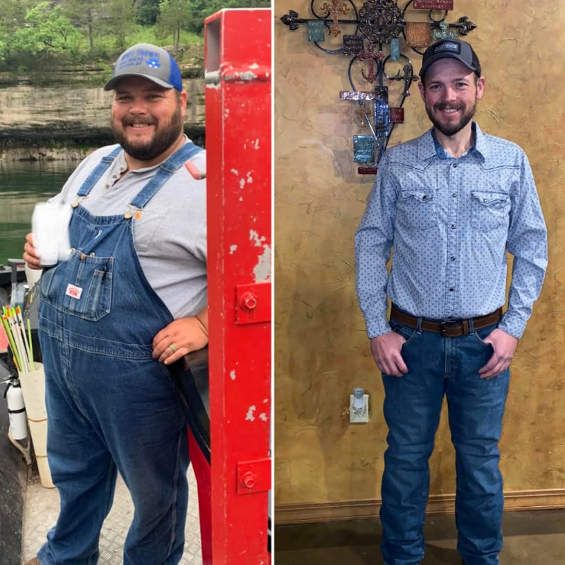 Before and after image of man from weight loss #2