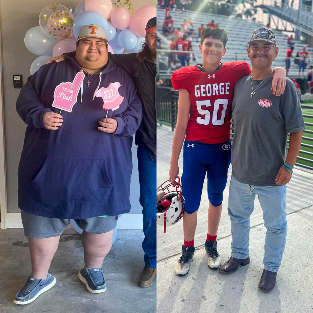 Medical Weight Loss in Tulsa Before & After Photos