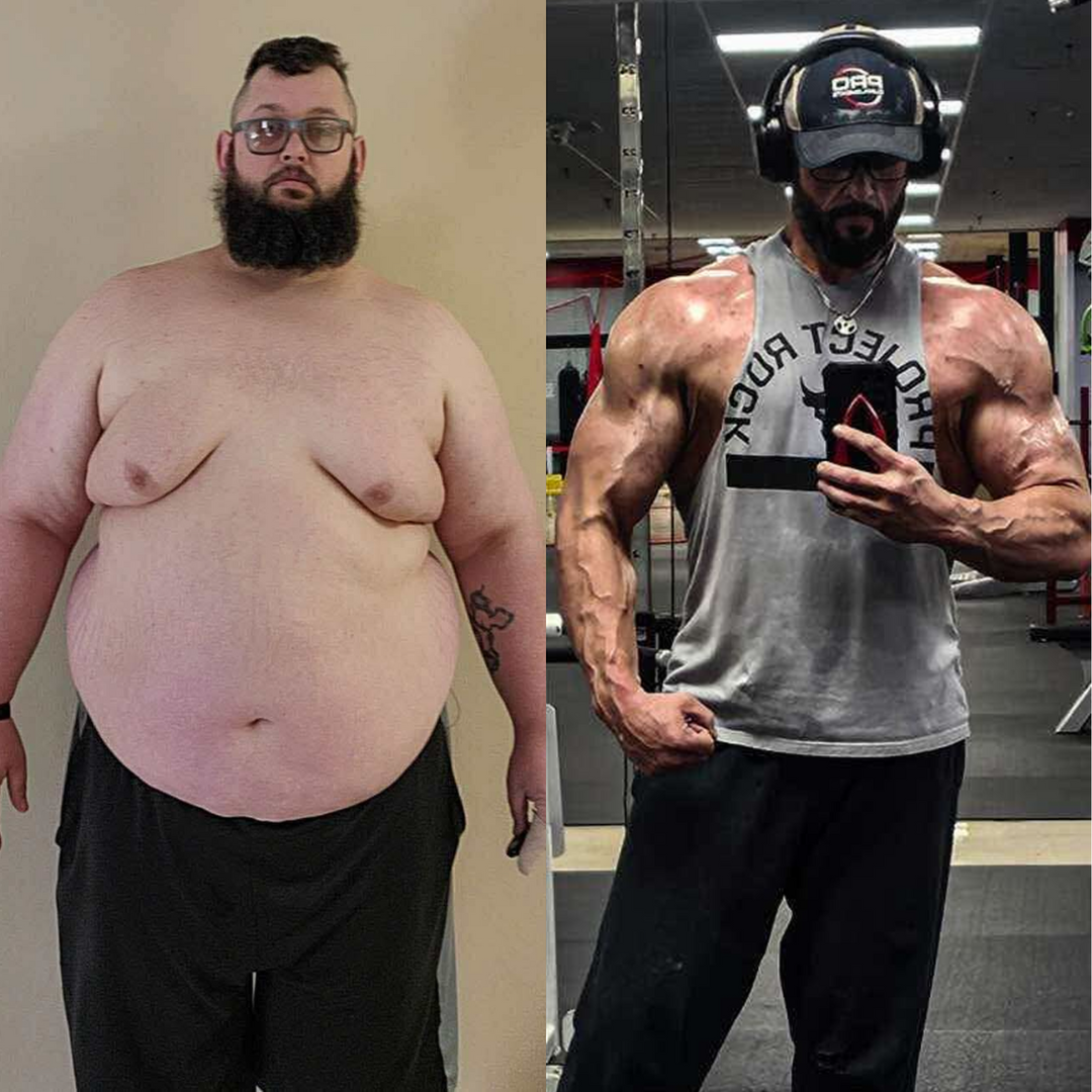 Medical Weight Loss in Tulsa Before & After Photos