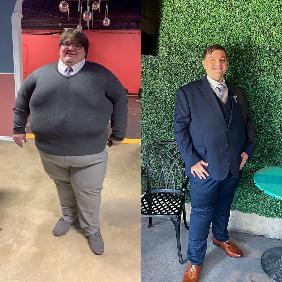 Medical Weight Loss in Tulsa Before & After Photos