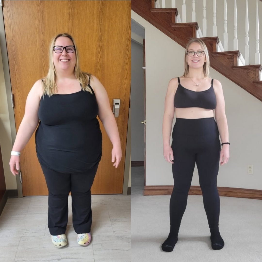 Medical Weight Loss in Tulsa Before & After Photos