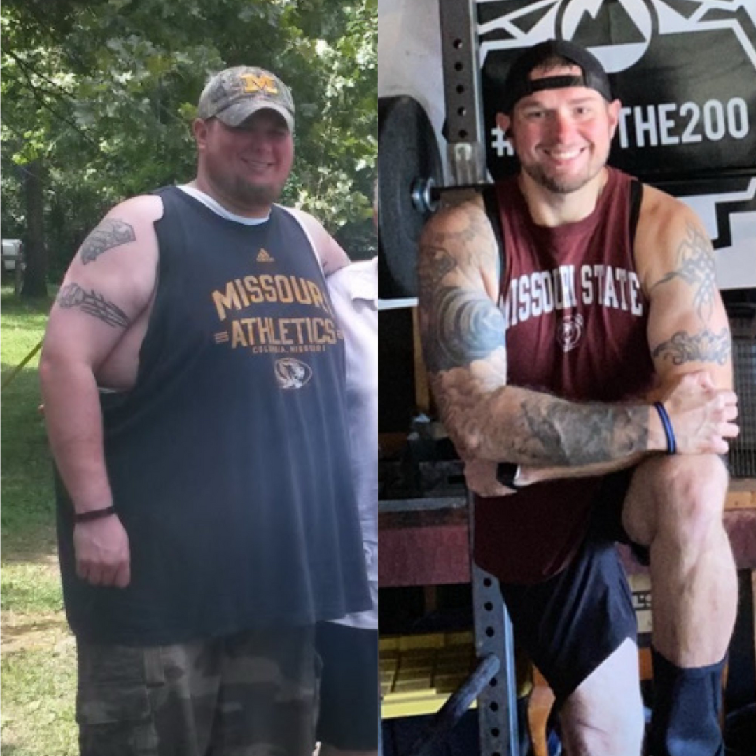 Medical Weight Loss in Tulsa Before & After Photos