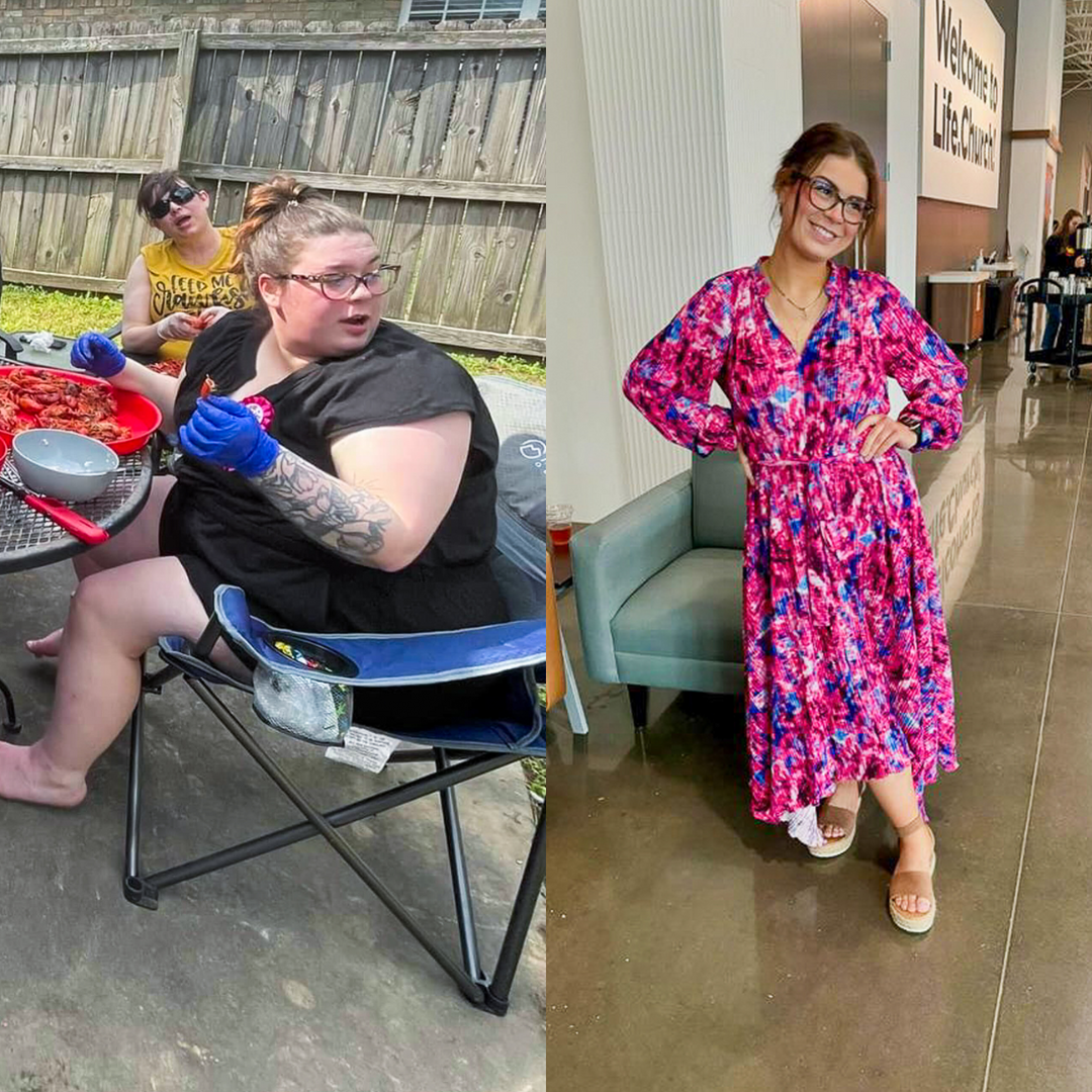 Medical Weight Loss in Tulsa Before & After Photos