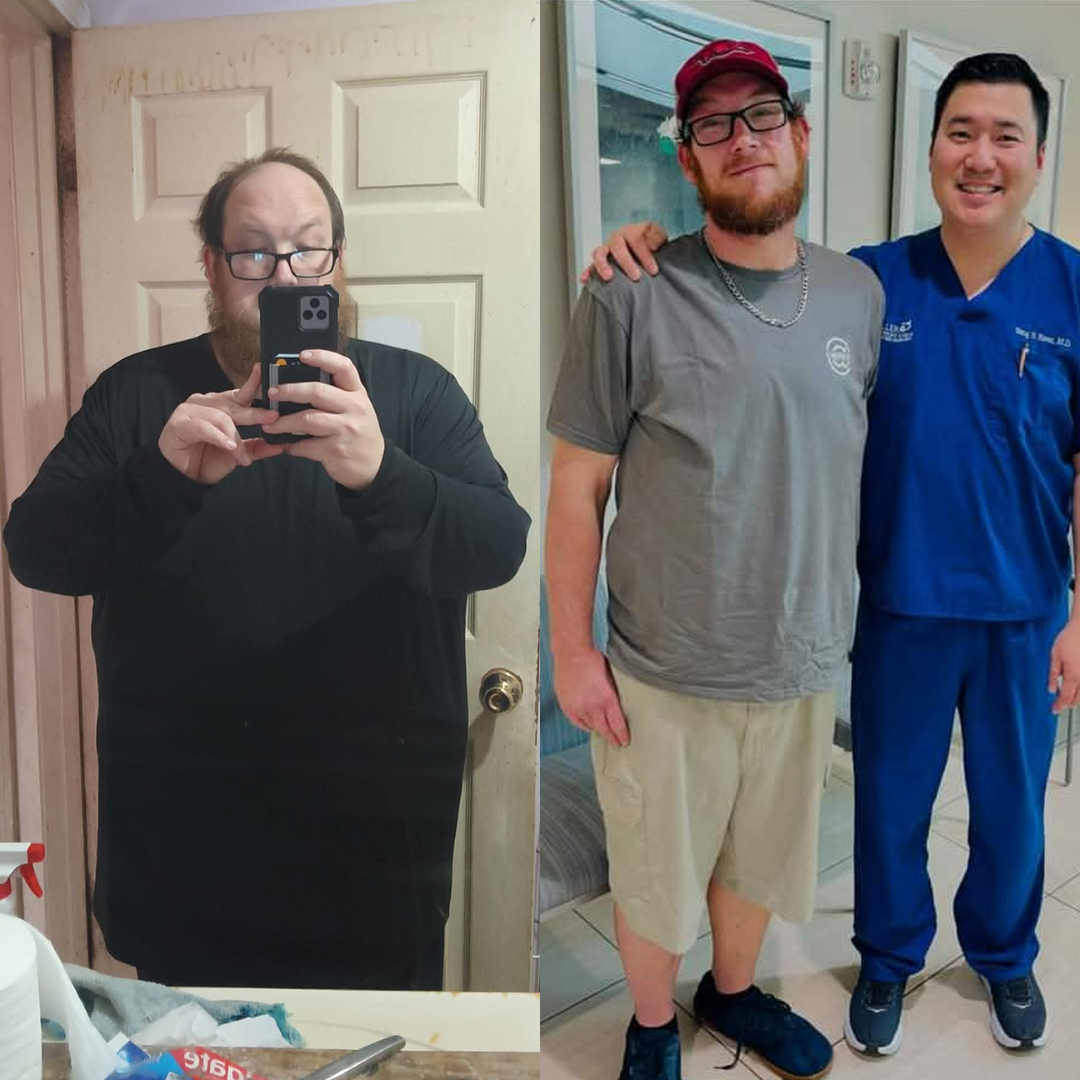Medical Weight Loss in Tulsa Before & After Photos