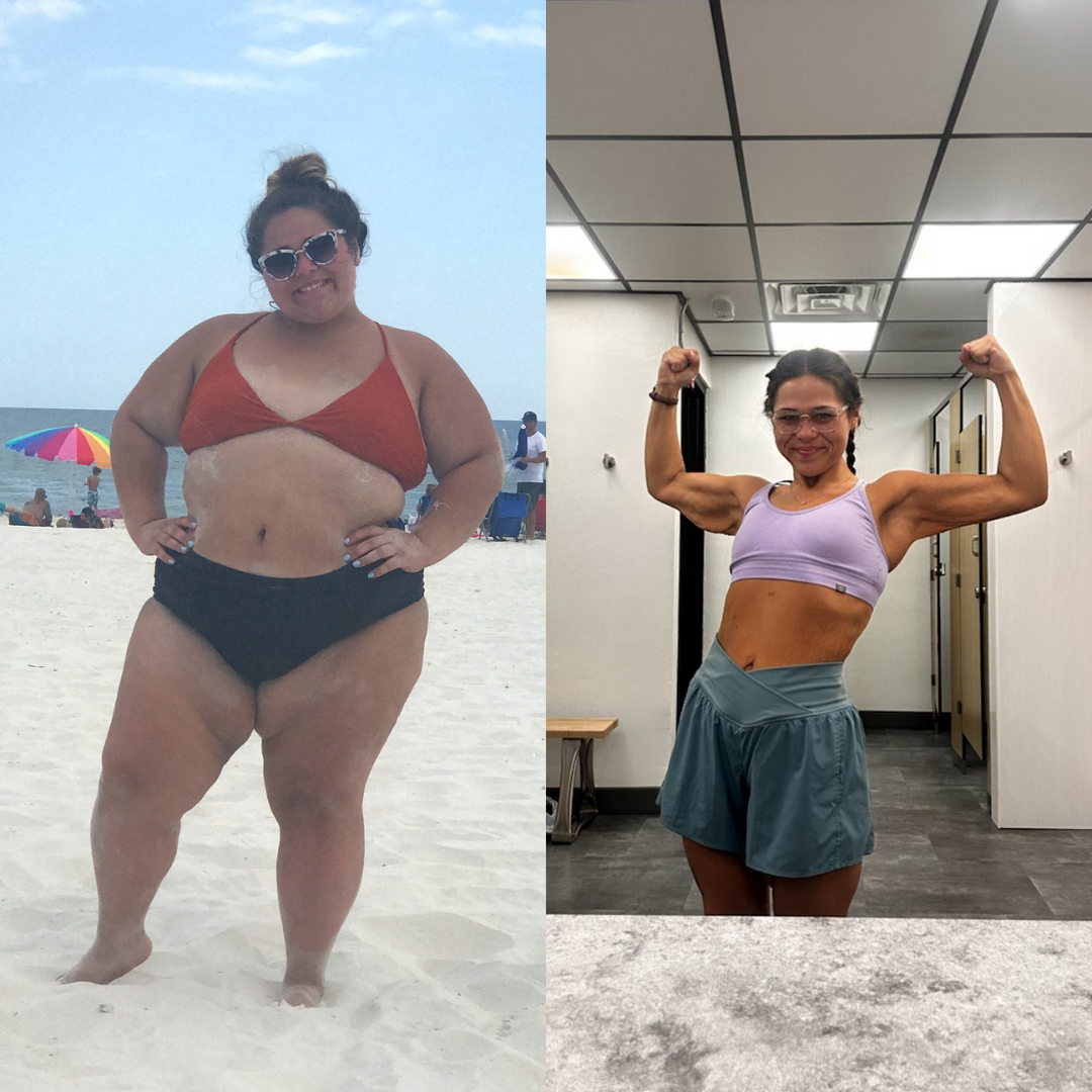 Medical Weight Loss in Tulsa Before & After Photos