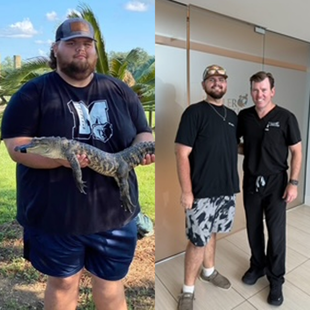 Medical Weight Loss in Tulsa Before & After Photos